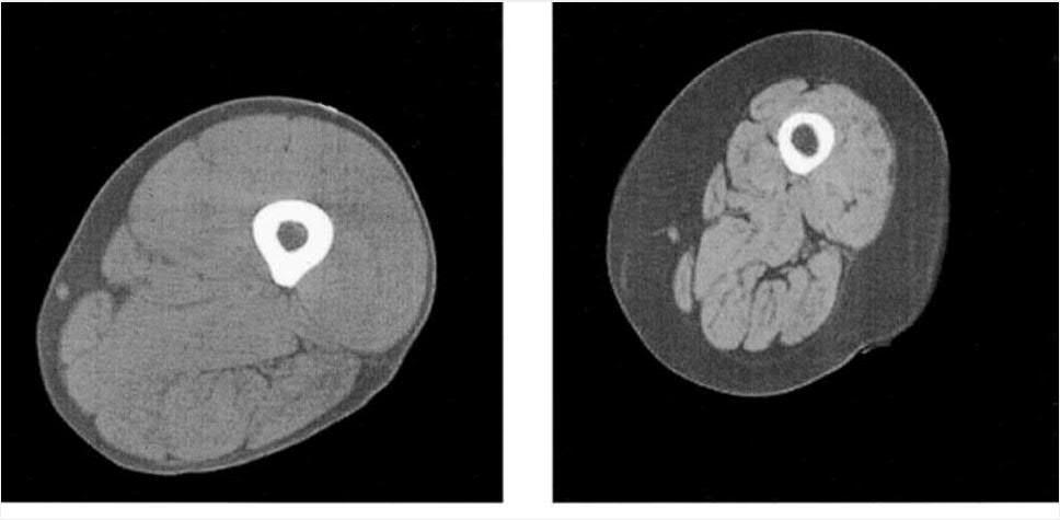 nuori vanha Noin 0.5 % per vuosi (Mitchell ym. 2012 Front Physiol) Lihasmassan vähentyminen vuodepotilailla on 3-4 % per päivä (Helliwell ym.