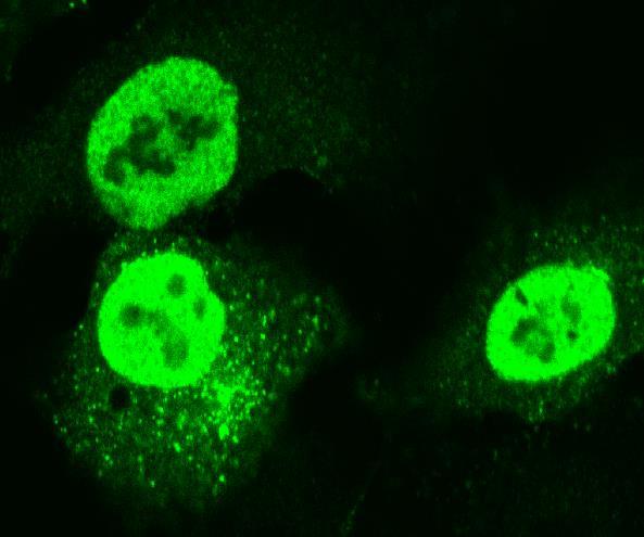 Influenssa A-viruksen lisääntyminen solussa Endosomi fuusio Vesikkelit Ribosomi Influenssa A-virus Endosytoosi Tuma Nucleokapsidit mrna Ensivaiheen mrna-synteesi PB1, PB2, PA NP, NS1, NS2