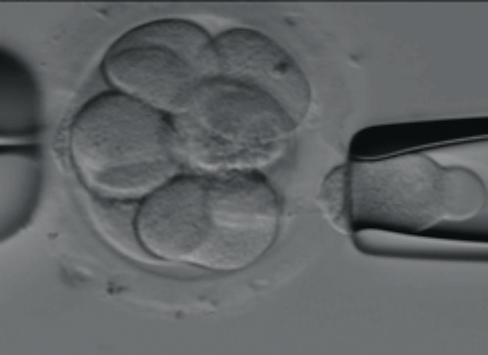 Blastomeeribiopsia tehdään kolmantena päivänä hedelmöityksestä. Alkiot ovat silloin 6 12-soluisia, ja alkiosta on mahdollista ottaa yksi tai kaksi solua (KUVA 2A).