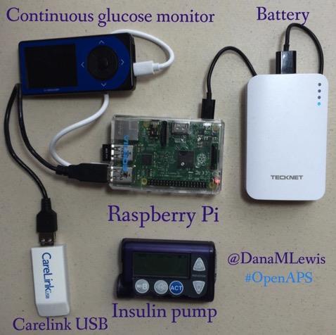 OpenAPS.org & DIYPS.org #WeAreNotWaiting T1D potilaiden ja T1D lasten vanhempien liike Miksi teknologia otetaan sairaanhoidossa käyttöön hitaasti?