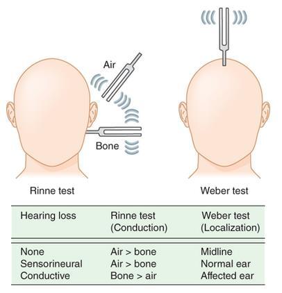 33 Potilaan kuulovian tyyppiä määrittäessä voidaan käyttää apuna äänirautakokeita. Tarkempaan diagnostiikkaan ja kuulovian vaikeusasteen määrittämiseen tarvitaan kuitenkin aina audiometriaa.