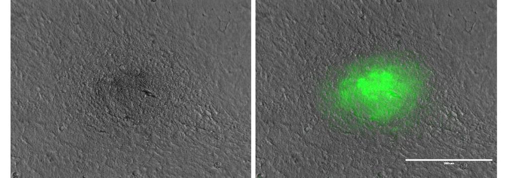 calcium oscillations in beating cardiomyocytes transfected with the reporter vector should result in green fluorescent flashing (Addis et al. 2013).