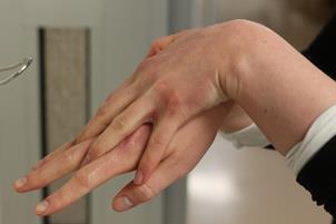 Aloita käsihuuhteen hierominen sormenpäistä ja peukaloista. Huomioi, että laitat käsihuuhdetta molempien käsien sormiin.