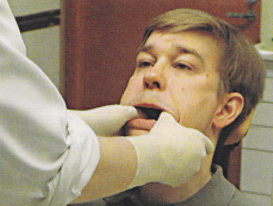 8. Hampaan katoaminen nieluun Hammas pyöreä ja liukas > irtoaa pihdeistä Potilaan kieli ja nielu puuduksissa Jos hammas putoaa kielelle TOIMI NOPEASTI Käännä potilaan pää heti itseesi päin ja lattiaa