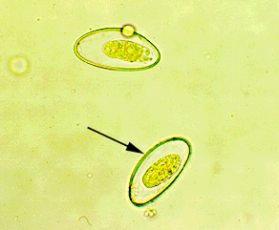 ÄITI, PEPP KTISEE TAAS kihomato ( Enterobius vermicularis )