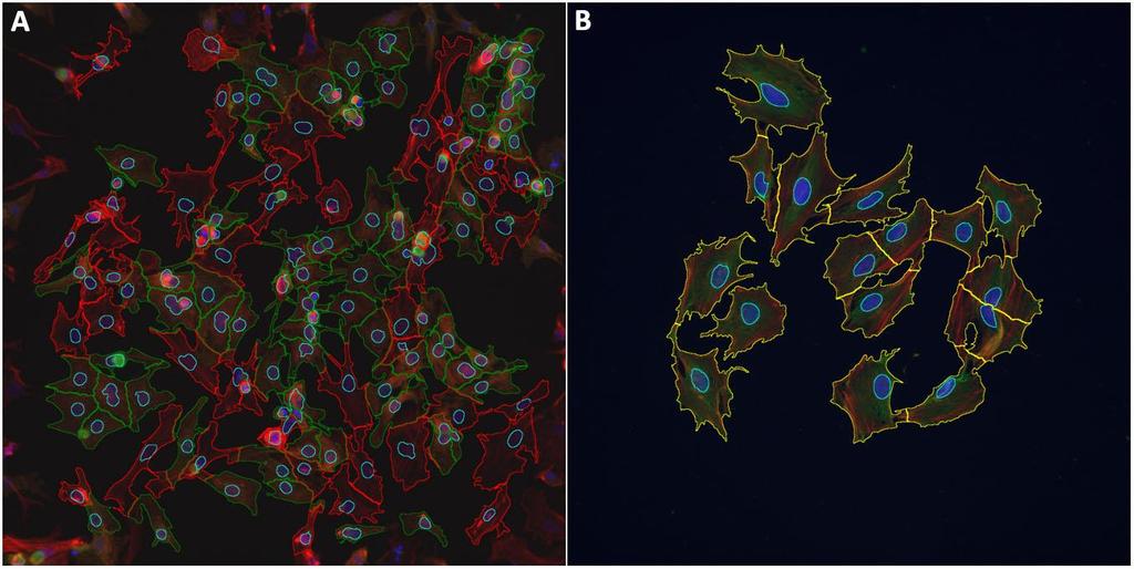 47 Kuva 5. Esimerkit CellProfiler-ohjelman tekemistä primäärikardiomyosyyttien (A) ja H9c2- solujen (B) tumien ja solujen tunnistuksesta. Tumien rajat on piirretty sinisellä.