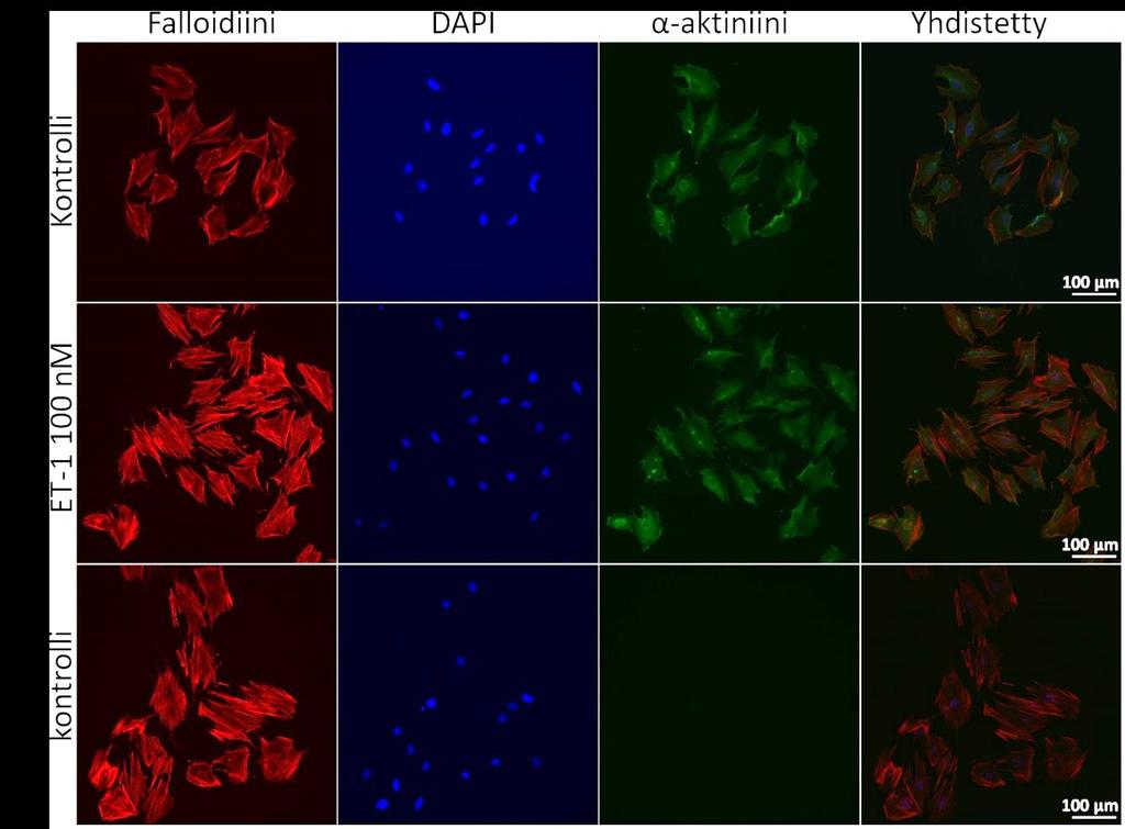 57 Kuva 12. Endoteliini-1:n (ET-1) vaikutus H9c2-solujen morfologiaan 48 tunnin altistuksen jälkeen.