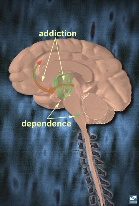 Opioid binding in