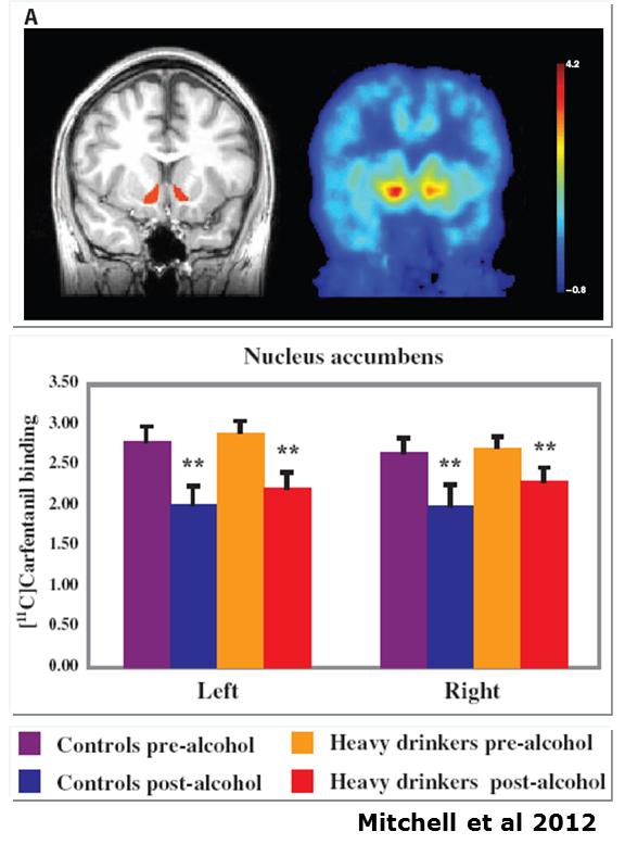 Acute alcohol consumption induces β-endorphin release in the human β -endorphin release in response to acohol (human) brain β-endorphin induces euphoria and pleasure, which contributes to the