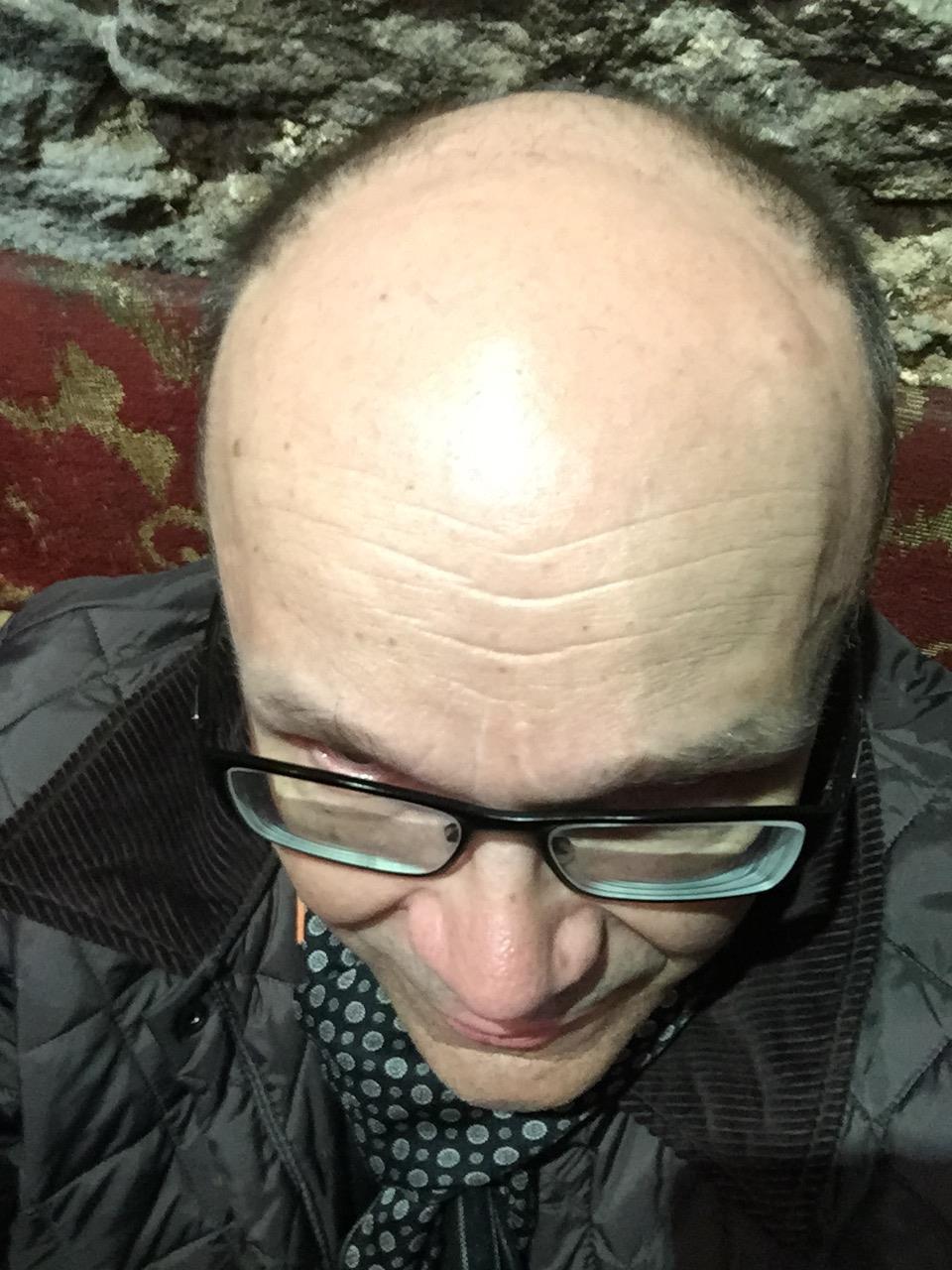 En vieläkään vastannut kysymykseen Miksi Käypä hoito suositus