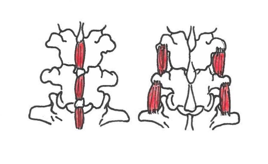 14 Kuva 2. M. interspinales ja m. intertransversarii medialis. Lannerankaa tukevat eniten lihakset, jotka sijaitsevat mediaalisesti rangassa. Erityisesti m.