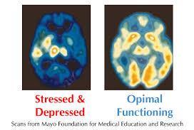 Stressaantuneet aivot eivät
