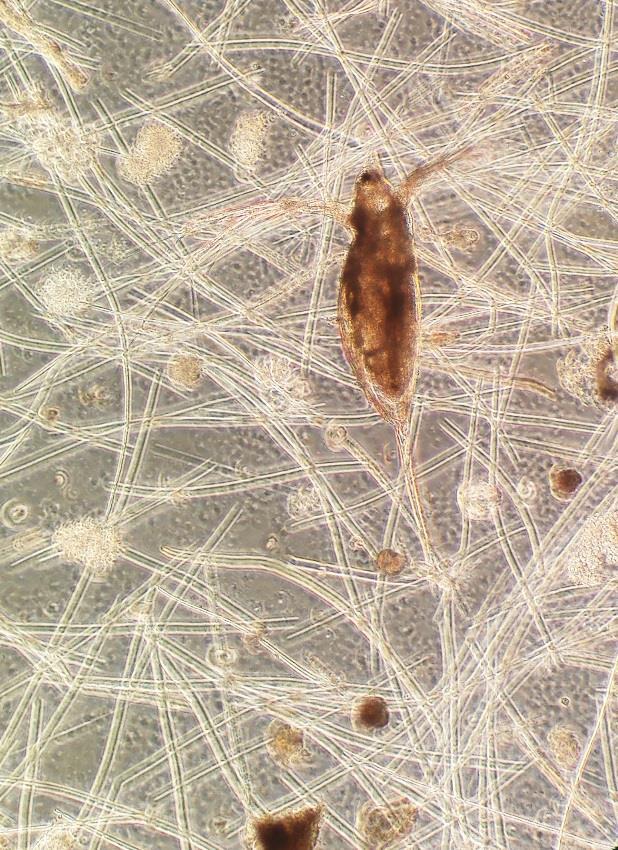 Vaikka rehevä järvi tuottaa paljon biomassaa, kasvamiseen tarvittavat välttämättömät rasvahapot laimenevat tuohon suureen biomassaan (Taipale ym. 2016).