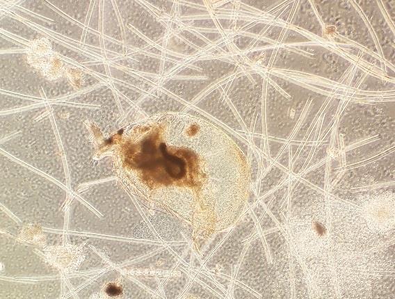 cristata, joka muodosti myös toisen alhaisemman biomassahuipun syyskuussa yhdessä D. cucullatan kanssa. Enonselällä yleinen muttei kovin runsaslukuinen D.