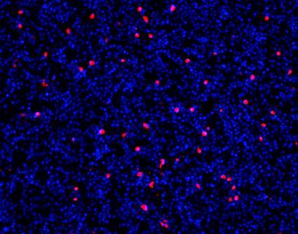 AUTO - fluoresenssimikroskoopilla.