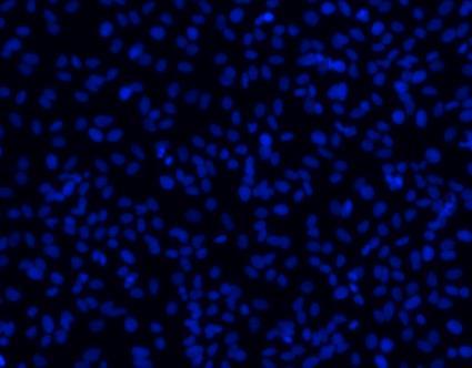Etenkin IVT-RNA-transfektiolla tuotettu virus infektoi solut myös alhaisissa pitoisuuksissa aina 1/25 laimennokseen asti, mitä ei ole kuitenkaan näytetty kuvassa.