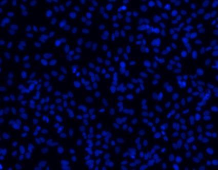 Etenkin IVT-RNA-transfektiolla tuotettu virus infektoi solut myös alhaisissa pitoisuuksissa aina 1/25 laimennokseen asti, mitä ei ole kuitenkaan näytetty kuvassa.