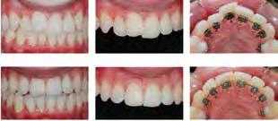 EverWhiteN 857-706IU, 016y, F3, 5 kpl 40734 EverWhiteN 857-716IU, 016a, F3, 5 kpl 40735 EverWhiteN 857-731IU, 16 x 16y, F3, 5 kpl 40736 EverWhiteN 857-741IU, 16 x 16a, F3, 5kpl 40737 EverWhiteN