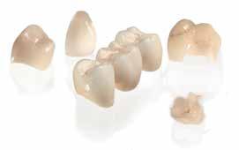 Paikkaushoitoon ja keramiaan CEREC parempaa hammashoitoa yhdellä hoitokäynnillä potilaidesi hyväksi Helppous CEREC-järjestelmän helppous syntyy yksikertaisesta jäljentämisestä, helppokäyttöisestä ja
