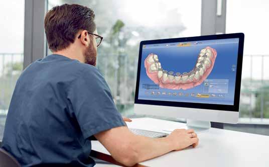 myös oikomishoitoa varten. CEREC Ortho on erillinen ohjelma, itseohjaava ja erittäin helppokäyttöinen.