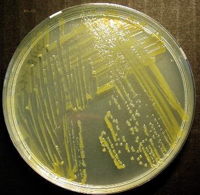 Flavobakteerit Flavobacterium columnare ja