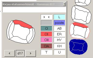 Statusmerkintöjen kirjaus-ikkuna Merkintä hammaskartalla (oikealla kuvassa) Ylempään hampaaseen