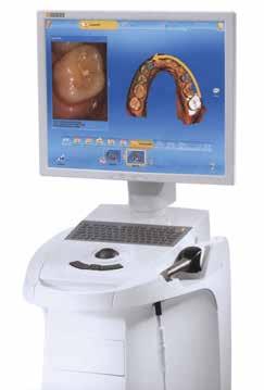 Oikomishoitoon Oikomiskalvot CEREC ORTHO HELPPO: DIGITAALINEN JÄLJENNÖS NOPEA: ANALYYSI DIGITAALINEN: MALLIEN SIIRTO Fyysiset mallit