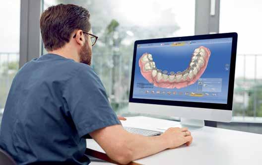 myös oikomishoitoa varten. CEREC Ortho on erillinen ohjelma, itseohjaava ja erittäin helppokäyttöinen.