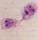 kannalta tärkeät ryhmät Bakteerit 1 µm Sienet