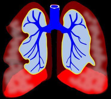Hengitys Hengitys on kaiken A ja O. Puheen tuotto ei ole mahdollista, jos keuhkoissa ei ole tarpeeksi ilmaa.