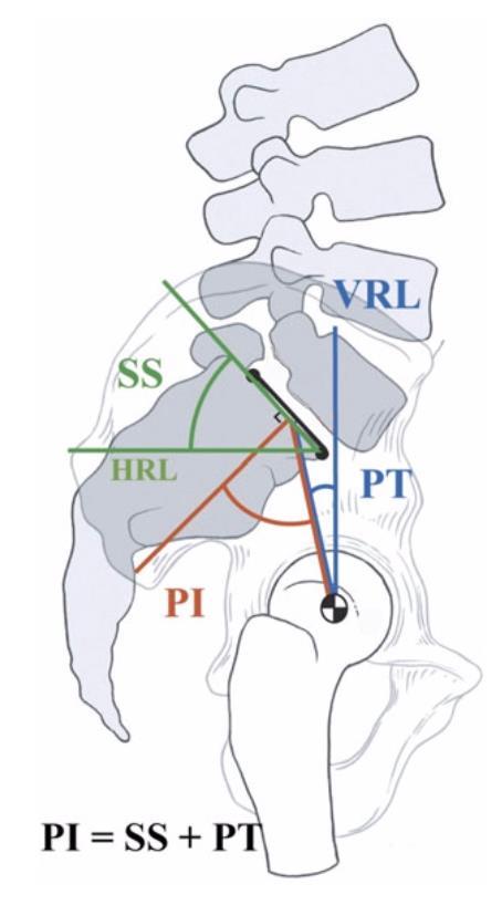 arvioida käyttämällä muun muassa seuraavia mittareita: PI (Pelvic Incidence), SS (Sacral Slope) ja PT (Pelvic Tilt) (kuva 12). (Wollowick & Sarwahi 2015, 19.) 22 KUVA 12.