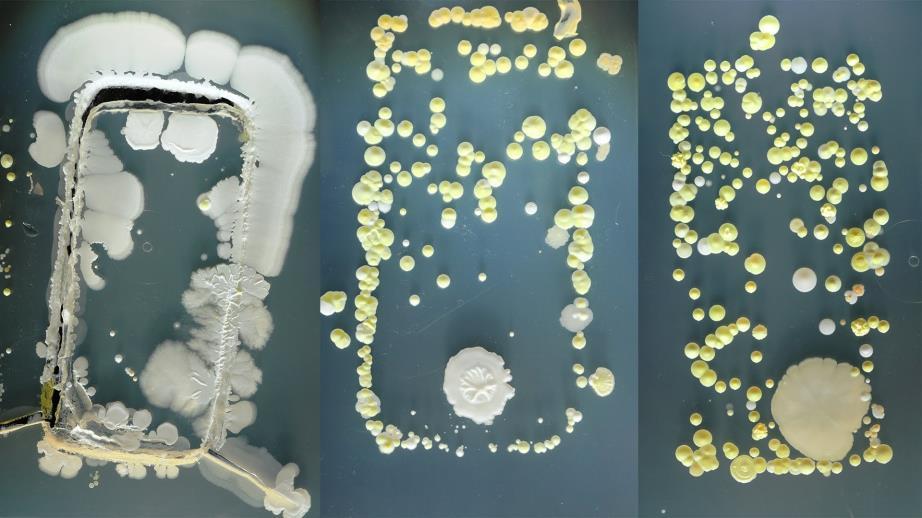 Mikrobit luonnossa Koko luonto ja eri sen eri eliöt (myös ihminen) on täynnä mikrobeja Mikrobit ovat välttämättömiä elämälle Ihminen on