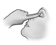 4. Slut ögat och tryck med fingret i den inre ögonvrån under ca en minut. På så sätt undviker du att ögondroppen rinner ner i tårkanalen. Tillslut flaskan ordentligt.