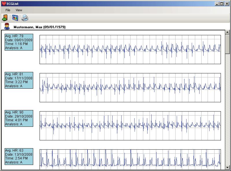 EKG-tietojen hallinta Muistikortille tallennetut tiedot voidaan kopioda tietokoneen kovalevylle ja tarpeettomat tiedot poistaa.