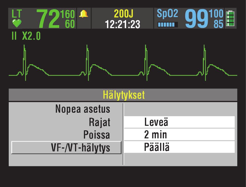 Perustietoja Valitse VF-/VT-HÄLYTYS, jos haluat aktivoida kammiovärinän ja kammiotakykardian jatkuvan valvonnan manuaalisessa tilassa.