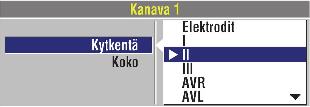 Valvonta EKG-kytkennän valitseminen ja vaihtaminen valitsimen avulla: 1 Valitse ensin KANAVA 1 ja sitten KYTKENTÄ, jotta saat ensisijaisen EKG-kytkennän vaihtoehdot näkyviin.