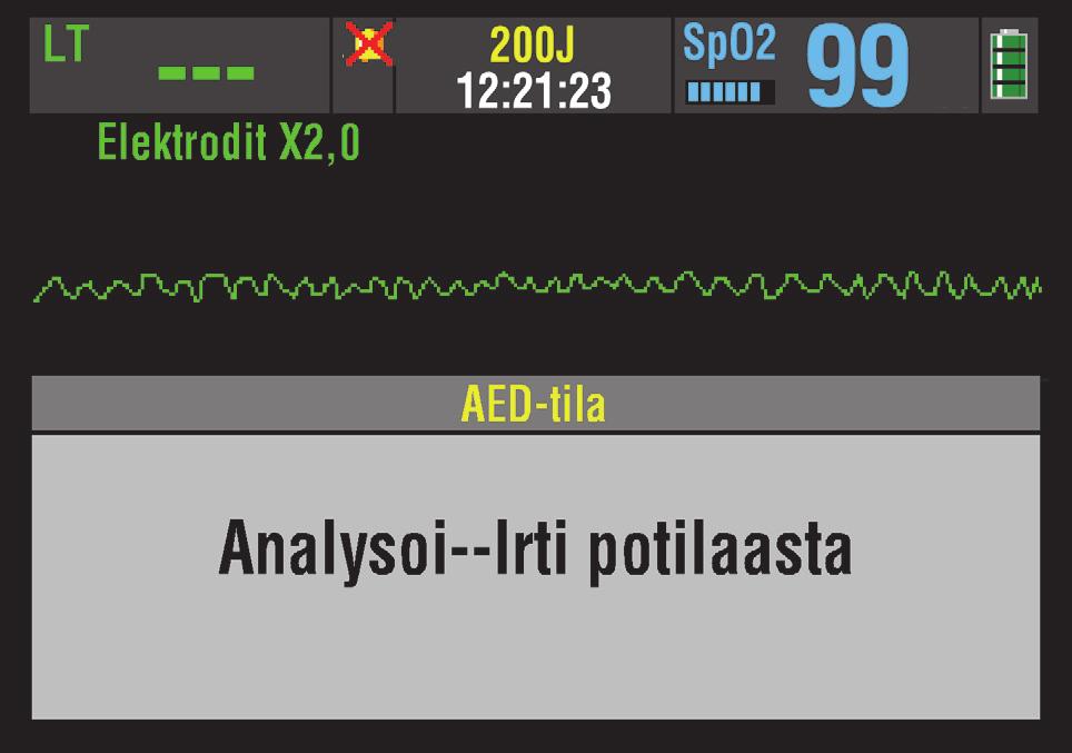 Hoito LIFEPAK 20e -defibrillaattori/monitorin asetukset voidaan määrittää niin, että EKG-käyrä näkyy tai ei näy AED-tilassa.