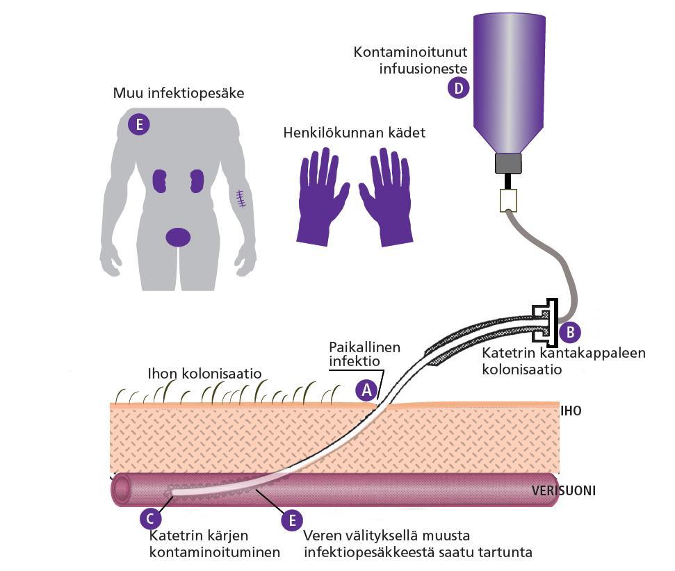 Verisuonikatetria ja sen pistokohtaa tarkkaillaan visuaalisesti ja sidoksen päältä palpoiden päivittäin.