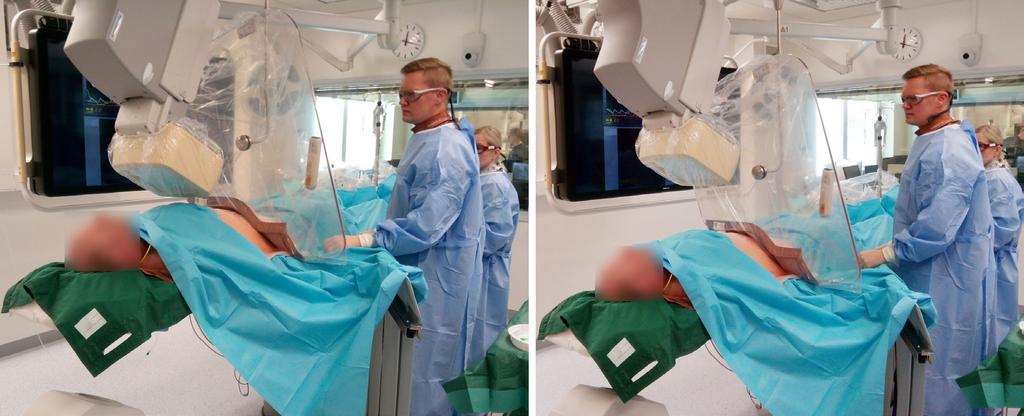 10 cm Potilaan ihon annos 1,0 > 0,87 annosyksikköä Röntgenputki Kuva 4.4. Tutkimuspöydän nostaminen mahdollisimman korkealle suurentaa potilaan ja ilmaisimen etäisyyttä röntgenputkesta.