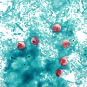 suoraan ulosteesta Cryptosporidium-värjäys (3444