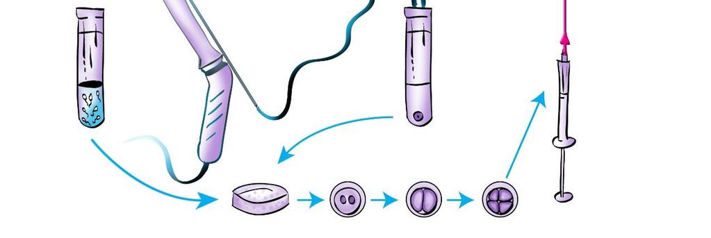 laboratoriossa Munasolut kerätään punktoimalla neulalla munasarjoista Alkion siirto takaisin kohtuun 2-5