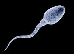 Sperma-analyysi- miehen hedelmällisyyden perustutkimus Sperma-analyysi on miehen osalta ensimmäinen vaihe lapsettomuustutkimuksissa Tutkimusten yhteydessä heikentynyt siemennesteen laatu löytyy noin