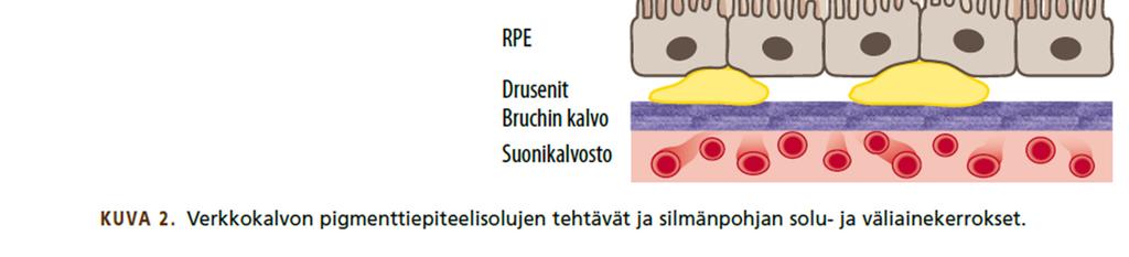 Ikääntyessä linssi sameutuu ja muuttuu vähemmän valoa läpäiseväksi sekä suodattaa lyhyen aallonpituuden sinistä valoa enemmän kuin nuorena.