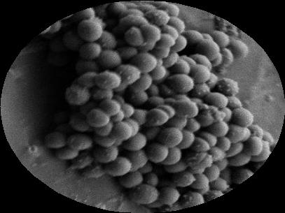 Staphylocuccus aureus Mikrobikasvusto ilman Bactiguard-pinnoitetta Mikrobikasvusto Bactiguard-pinnoitteella Bactiguard-pinnoitteeseen kiinnittyy vähemmän