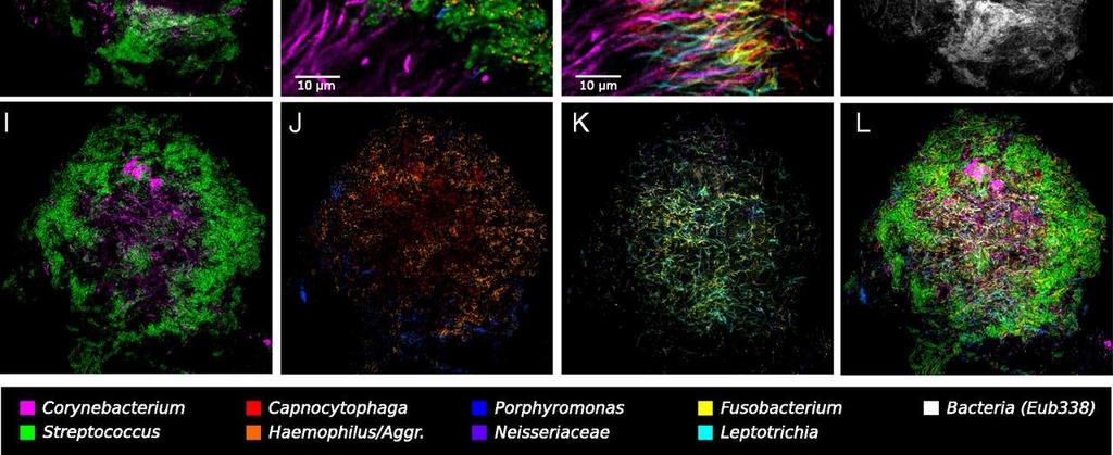 National Academy of Sciences A hedgehog structure in plaque showing spatial organization of the plaque microbiome. Jessica L.