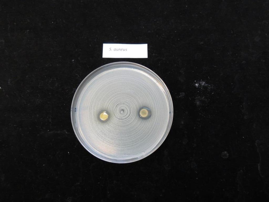 2 Tulokset Mikrobikasvatusmaljoilla havaittiin estokehä seuraavilla mikrobeilla: Staphylococcus aureus (Kuva 1.) Staphylococcus epidermidis (Kuva 2.) Streptococcus pyogenes (Kuva 3.) Kuva 1.