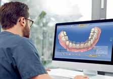 > Erittäin tarkat kokoleuan skannaukset CEREC Omnicam -suukameralla, joka on nopea, tarkka ja helppokäyttöinen.