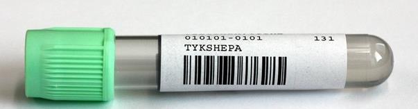 pitää laittaa putkeen, tieto tarvitaan analyysipisteessä