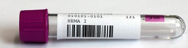 menevät EDTA-putket