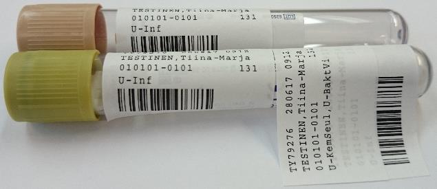 liimataan kumpaan tahansa putkeen Uloste.
